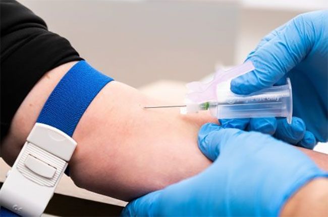 Medical lab fined Rs. 500,000 for charging excessive fee for FBC test Medical lab fined Rs. 500,000 for charging excessive fee for FBC test