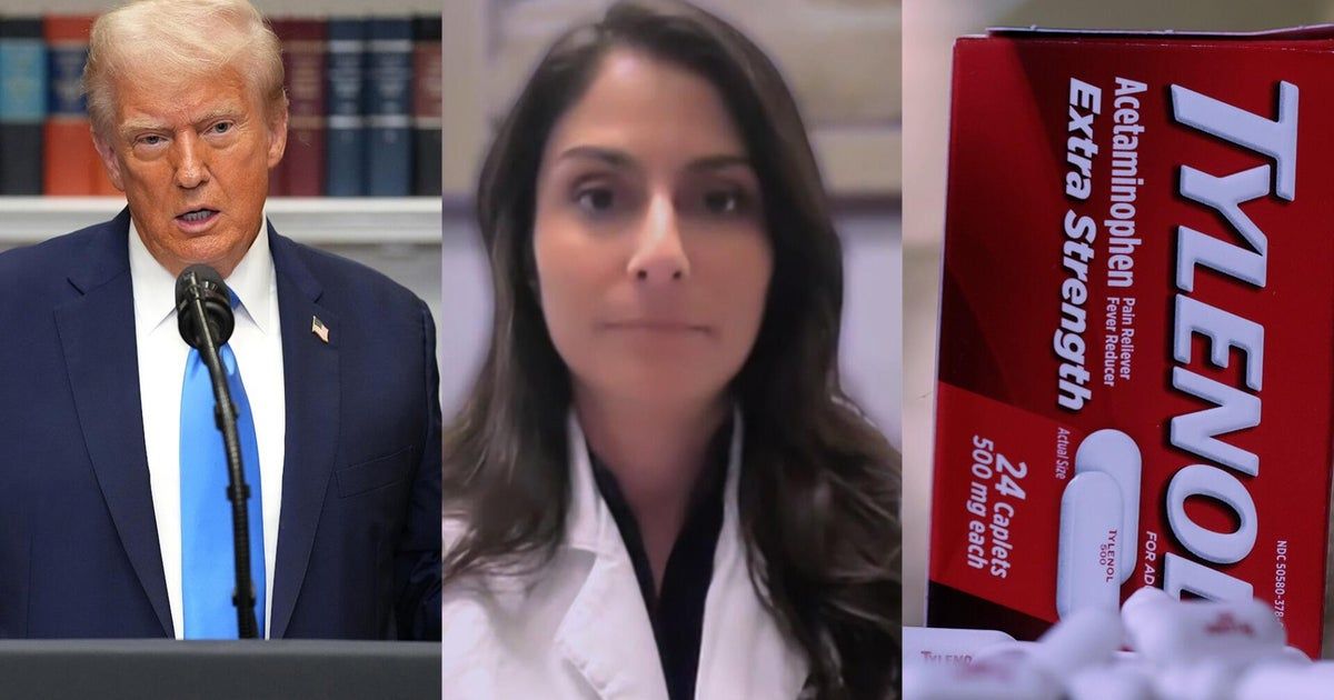 Doctor reacts to Trump’s announcement about Tylenol and autism