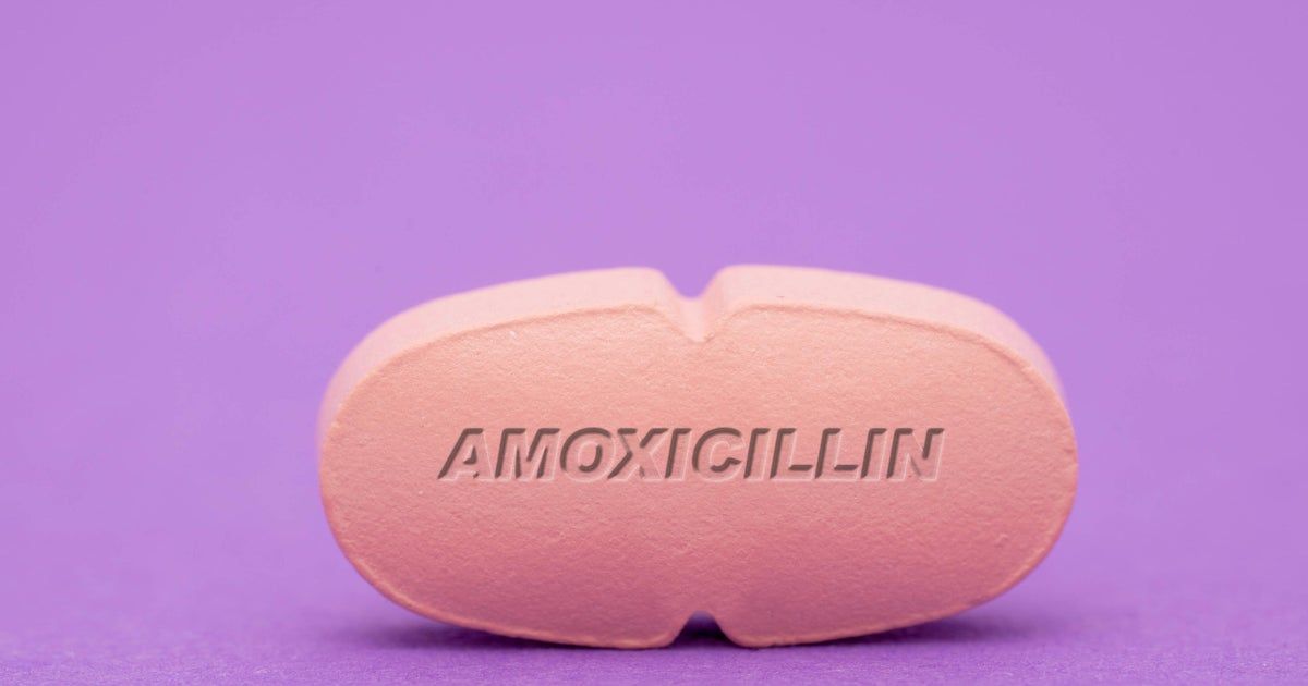 Amoxicillin shortage frustrates parents amid back-to-school strep outbreak