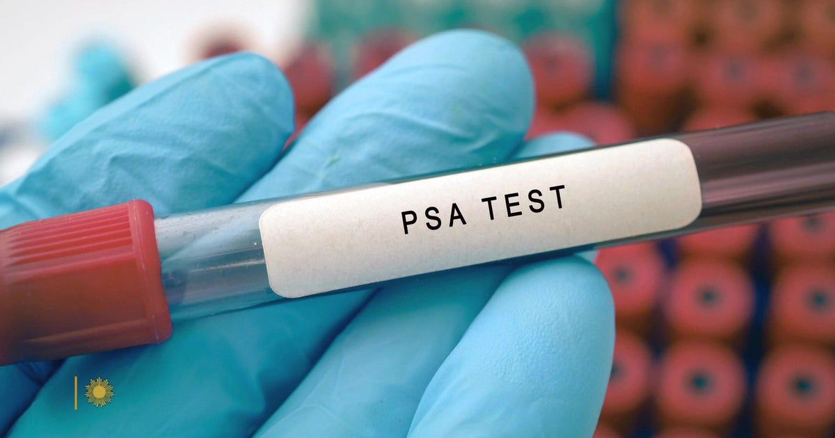 The prostate, and why it causes so many problems for men