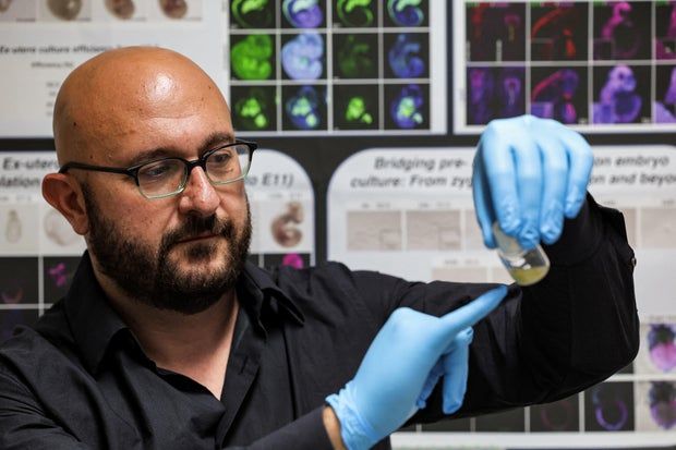 ISRAEL-HEALTH-MEDICINE-RESEARCH-INFERTILITY