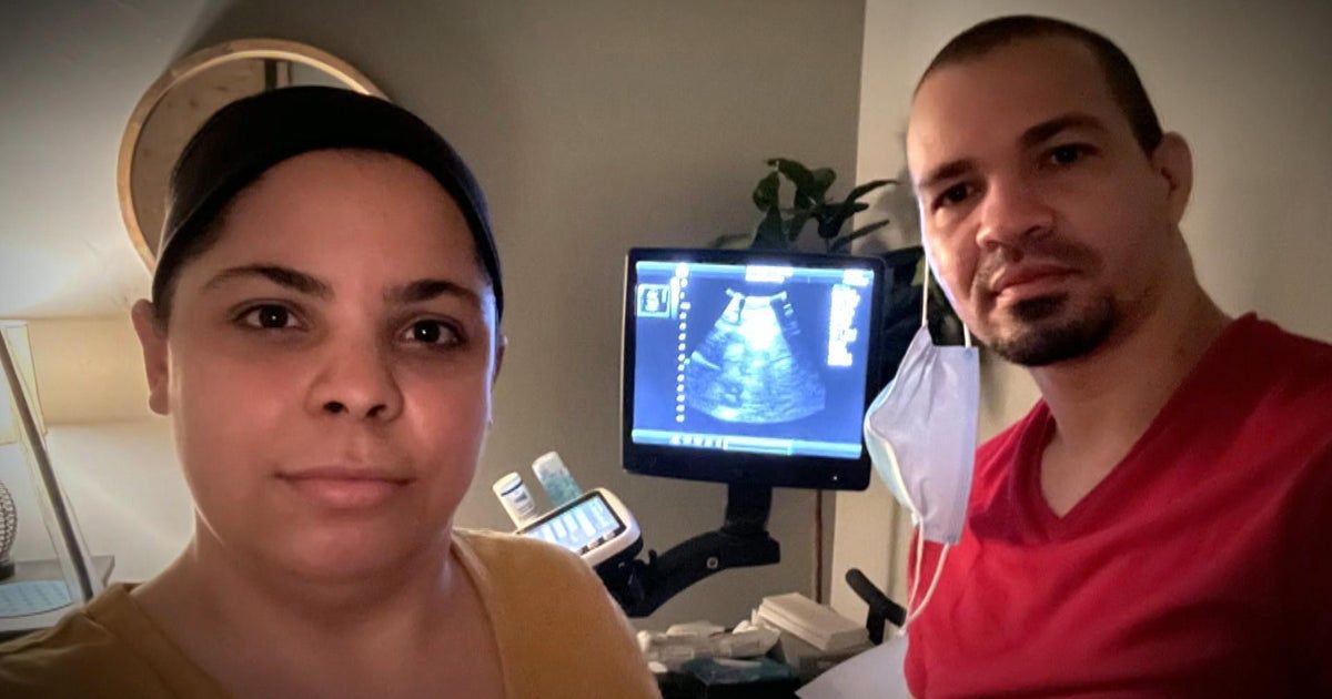 IVF costs put the fertility treatment out of reach for many Americans: “I don’t think it’s fair”