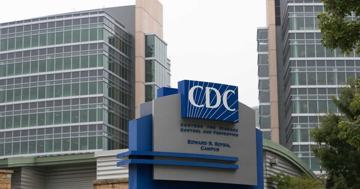 Weekly measles cases top 90 in U.S. for first time in years Weekly measles cases top 90 in U.S. for first time in years