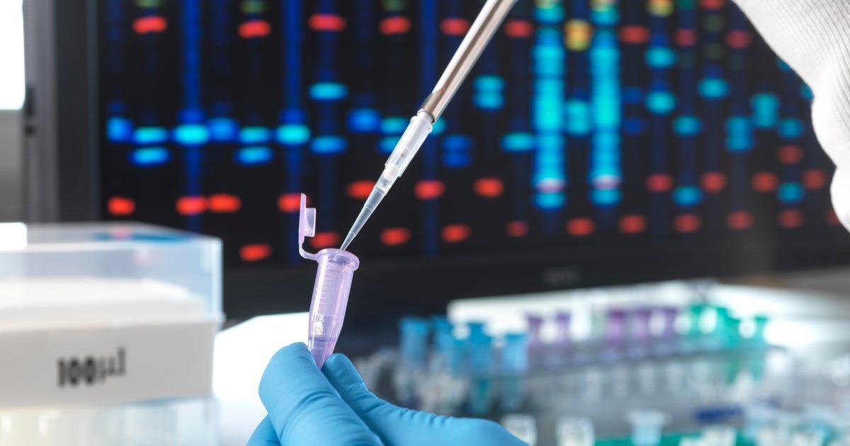 Is it genetic? What experts say about the risk of diabetes, Alzheimer’s, ADHD and more Is it genetic? What experts say about the risk of diabetes, Alzheimer’s, ADHD and more