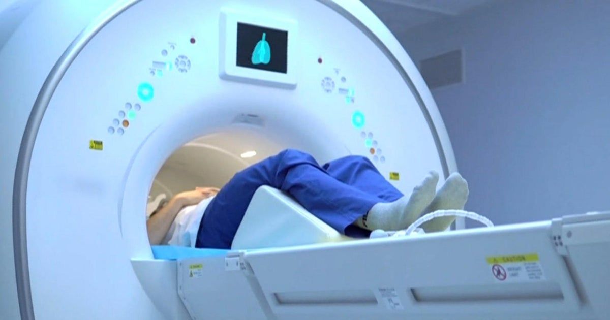 American Cancer Society lowers age threshold for lung cancer screenings American Cancer Society lowers age threshold for lung cancer screenings