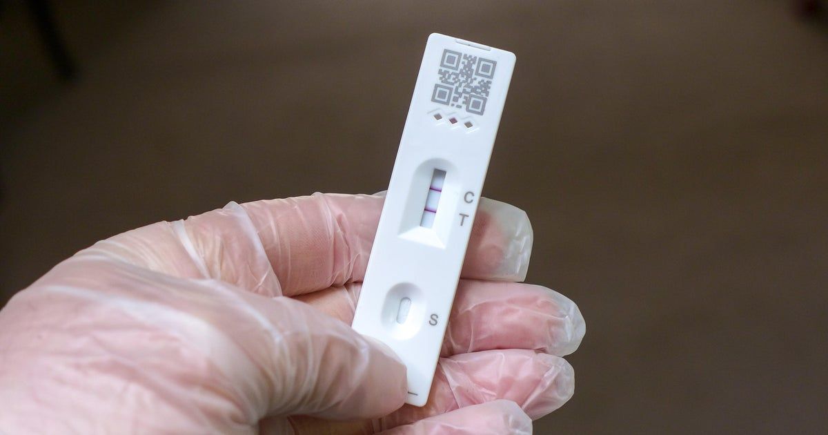 Do COVID-19 tests still work after they expire? Here’s how to tell.