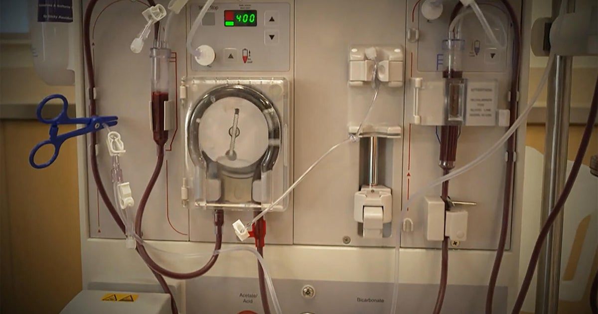 Kidney dialysis industry accused of maximizing profits over patients Kidney dialysis industry accused of maximizing profits over patients