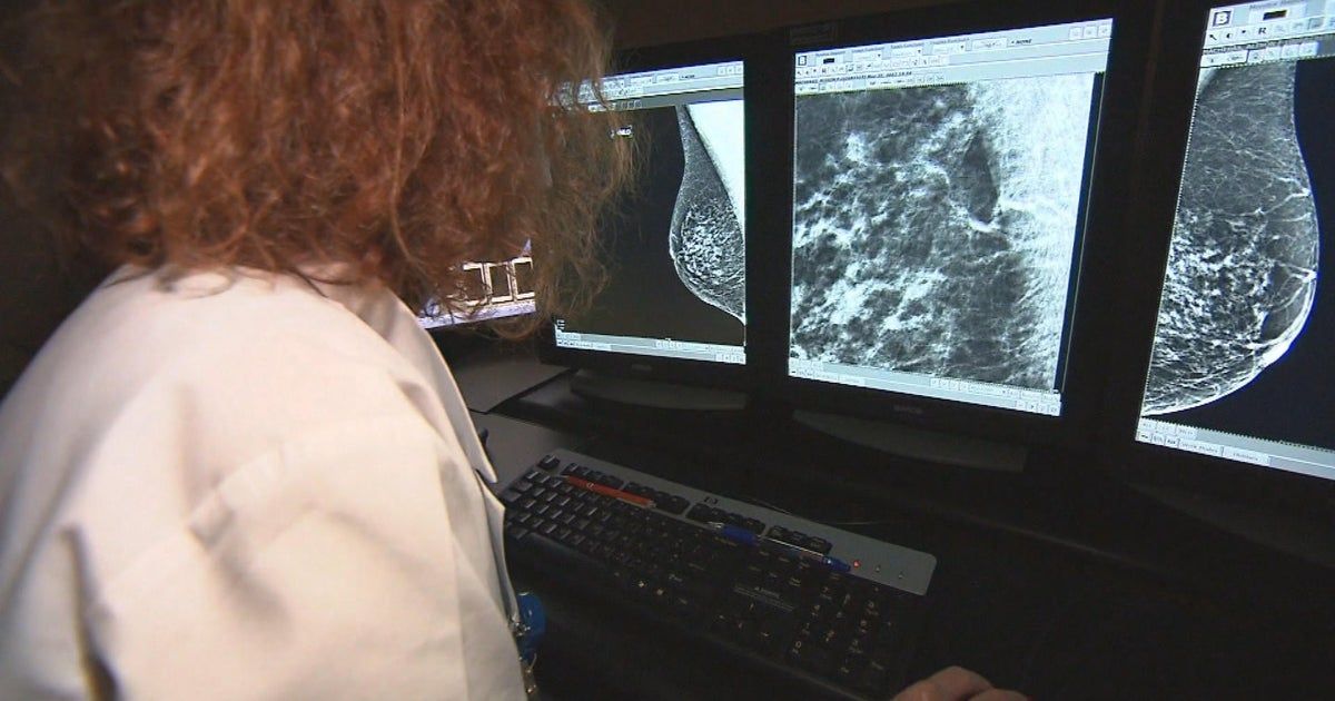 Data shows women are not getting recommended screenings for breast cancer Data shows women are not getting recommended screenings for breast cancer