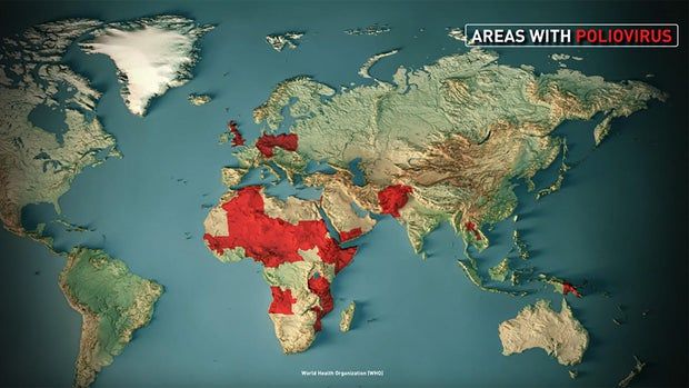 How safe is America from polio? 5 map-areas-with-poliovirus.jpg