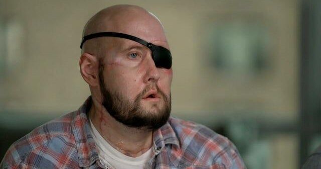 Man who narrowly survived electrical accident receives world’s first eye transplant Man who narrowly survived electrical accident receives world’s first eye transplant