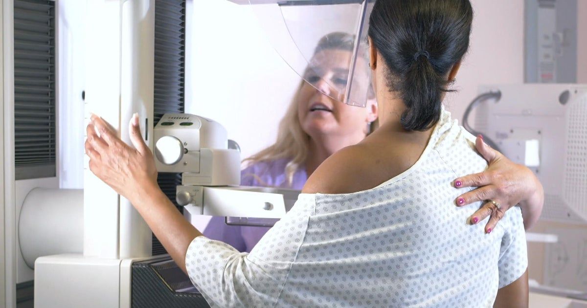 New Jersey woman shares cancer journey as alarming trend highlights American Cancer Society’s annual report New Jersey woman shares cancer journey as alarming trend highlights American Cancer Society’s annual report