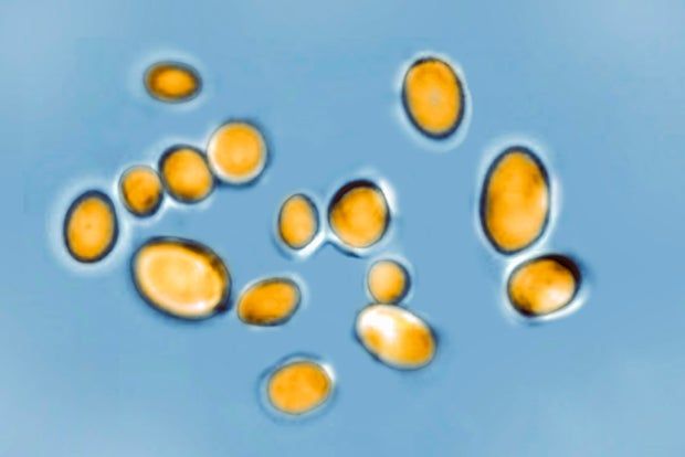 Candida auris, seen with an optical microscope, is a yeast responsible for many infections that's resistant to most antifungal drugs and has caused several deaths worldwide.