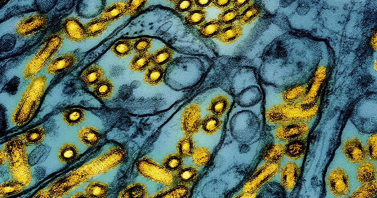 Bird flu case with