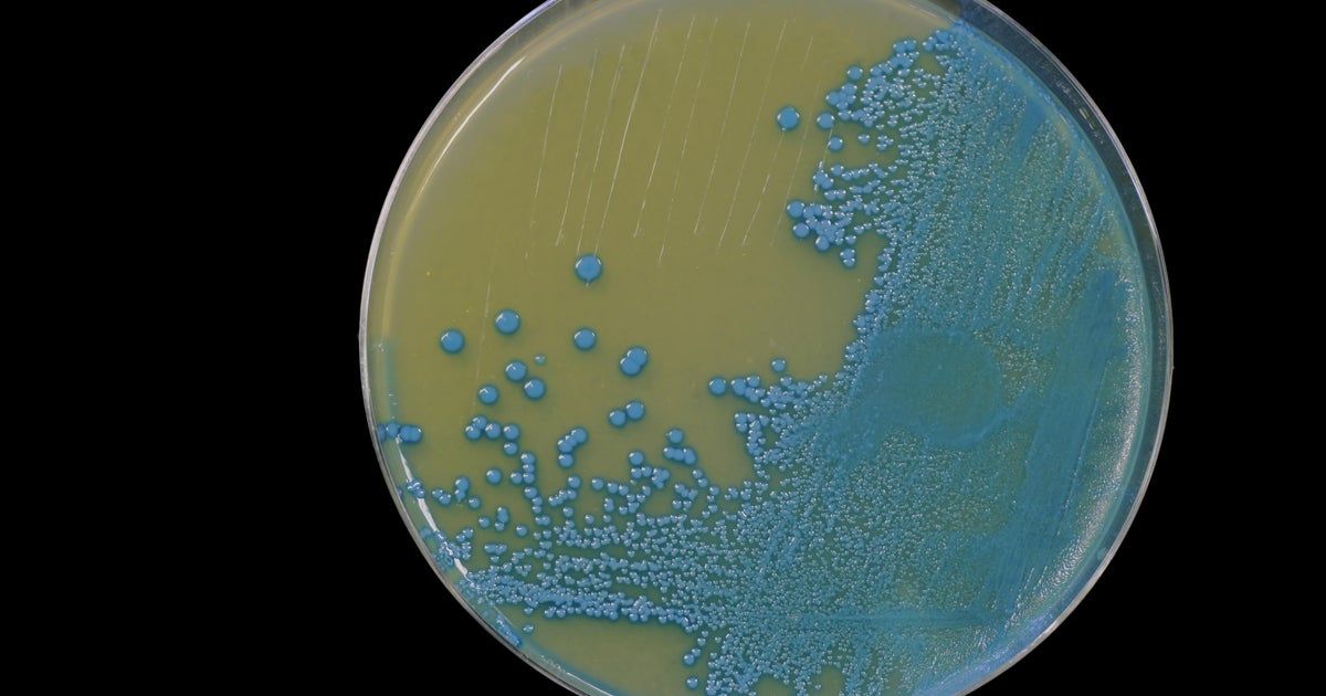 More than 2 dozen sickened in deadly multi-state listeria outbreak linked to deli meat, CDC says More than 2 dozen sickened in deadly multi-state listeria outbreak linked to deli meat, CDC says