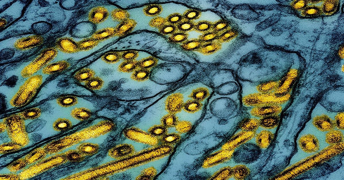 California declares emergency after severe U.S. case of H5N1 bird flu California declares emergency after severe U.S. case of H5N1 bird flu