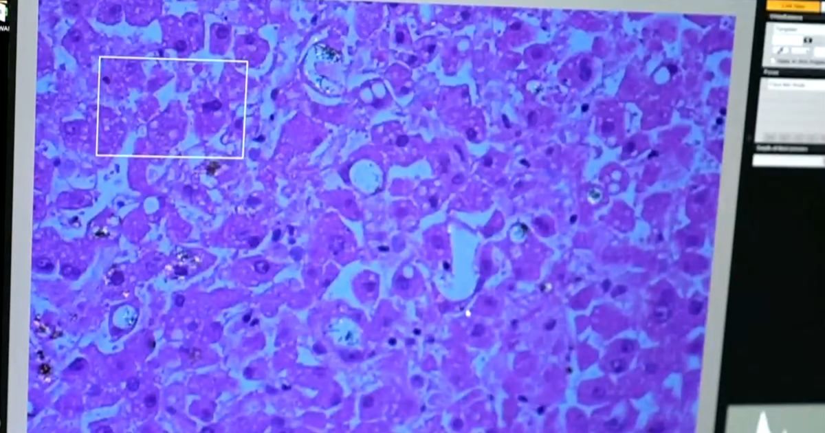 How nanoplastics may be impacting our long-term health