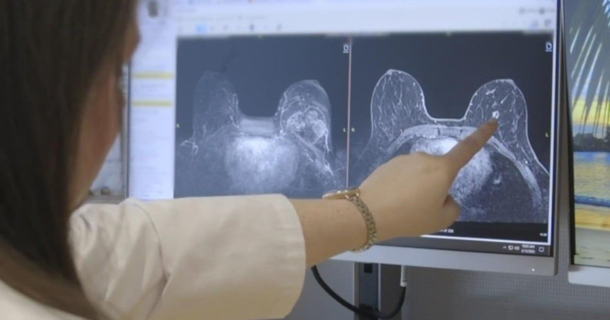 An end to breast cancer? California company develops groundbreaking vaccine with promising future An end to breast cancer? California company develops groundbreaking vaccine with promising future