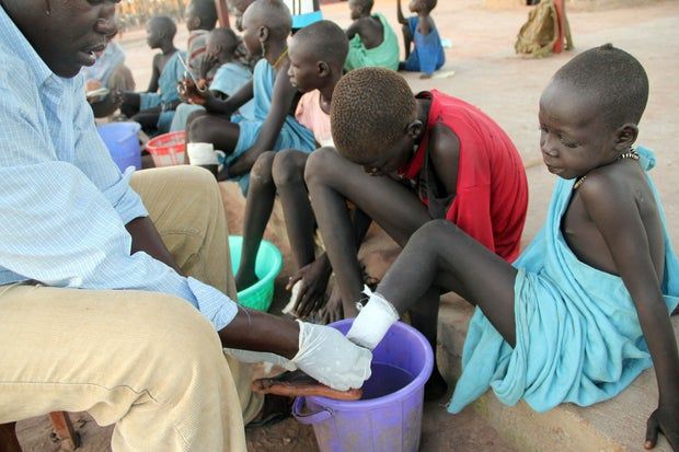 A year after Jimmy Carter's death, the disease he swore to eradicate reaches an all-time low 3 Jimmy Carter Guinea Worm