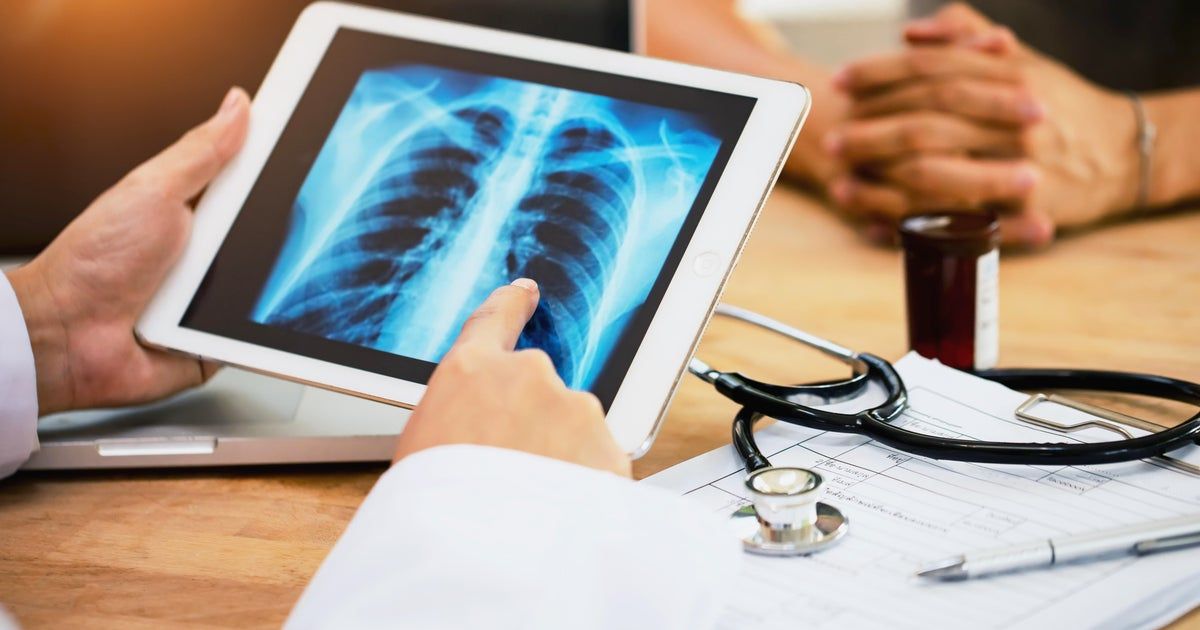 New study finds alarming rise in cancer rates among people under 50