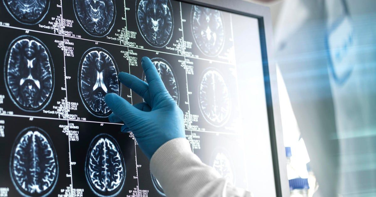 Cancer cases and deaths expected to surge among men in coming decades