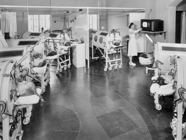 How safe is America from polio? 2 3b58b17b polio iron lungs getty 515427562