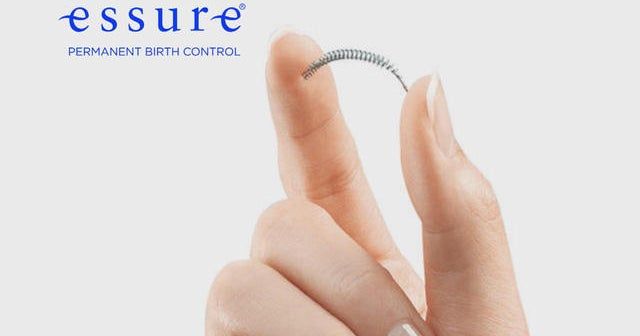 Thousands of women say Essure birth control caused intense pain Thousands of women say Essure birth control caused intense pain