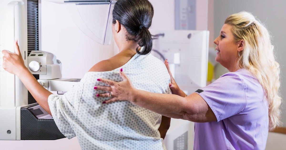More women are falling behind on breast cancer screenings, study shows More women are falling behind on breast cancer screenings, study shows