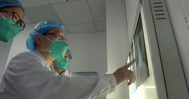Coronavirus virus case found in the U.S.