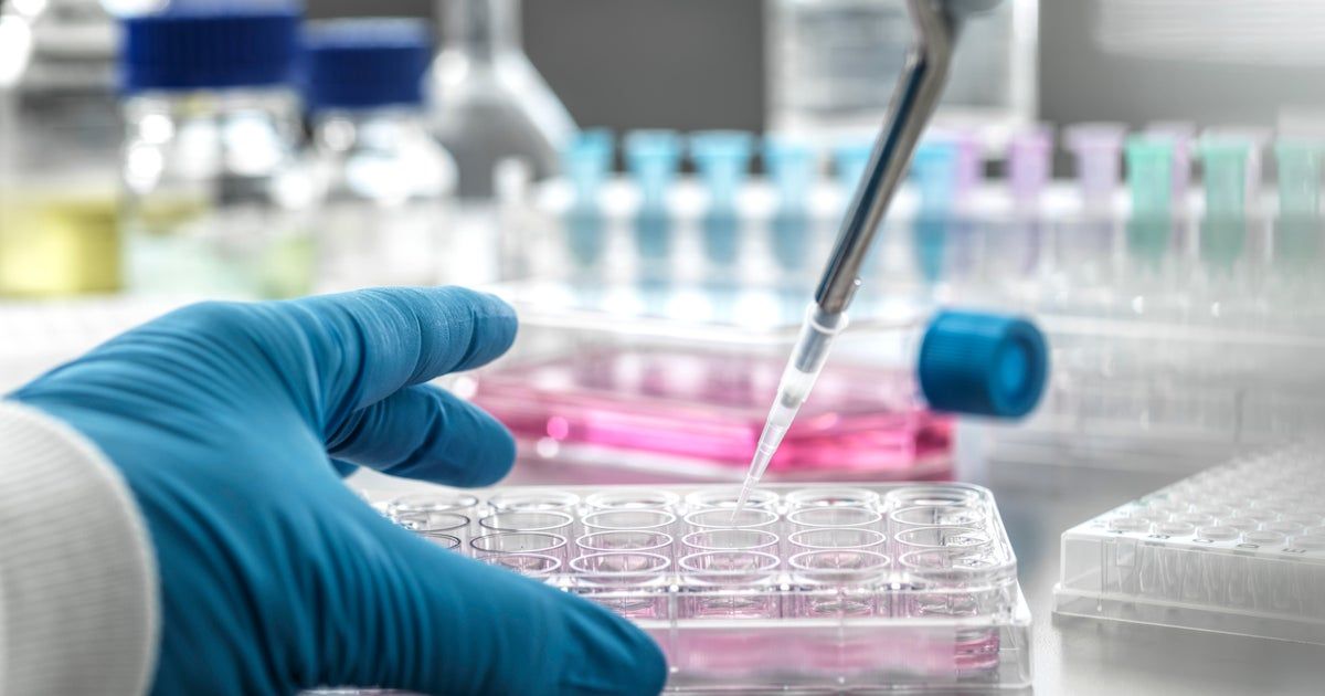States suing to stop Trump administration cuts to medical research funding