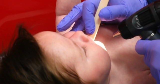 Supply of RSV antibody shot struggling to meet demand