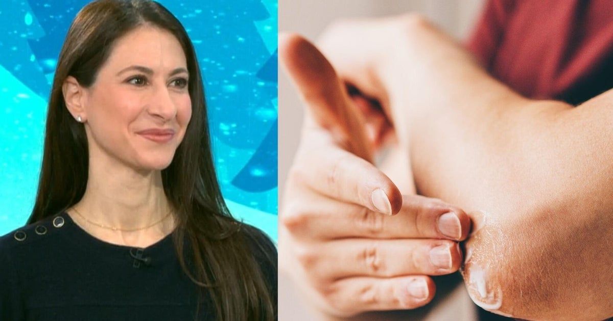 Dermatologist shares tips to help dry winter skin