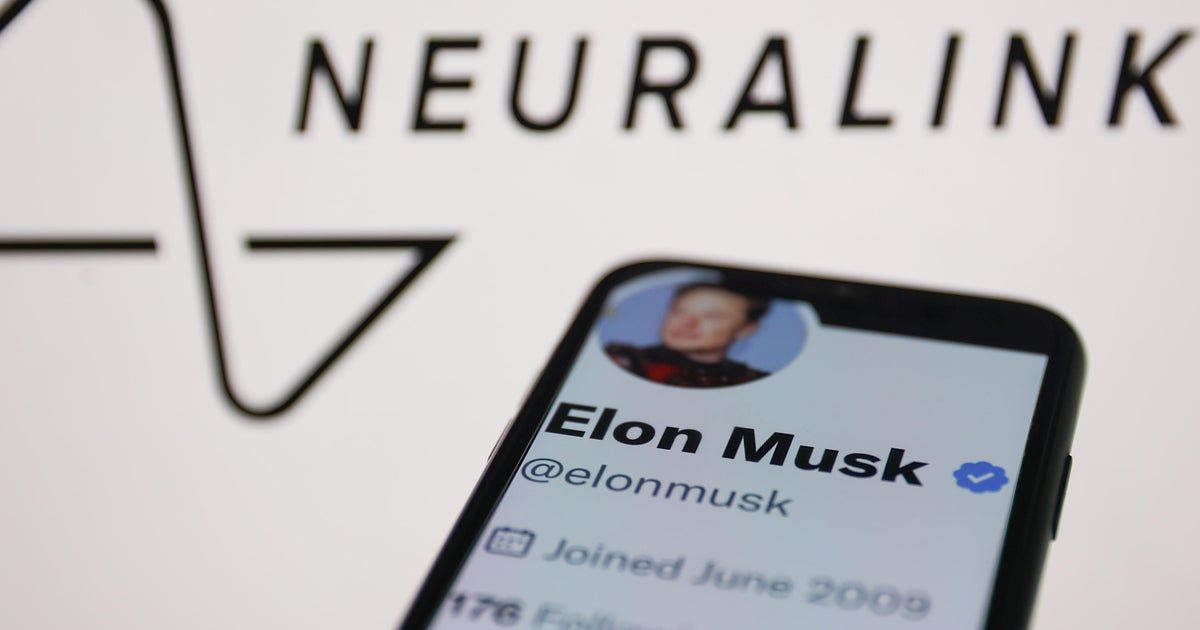 Neuralink brain-chip implant encounters issues in first human patient Neuralink brain-chip implant encounters issues in first human patient
