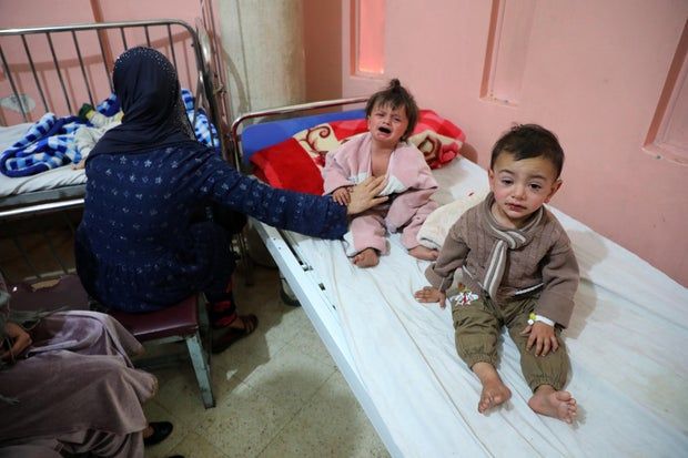 More than 130 children died in 4 months due to measles in Afghanistan
