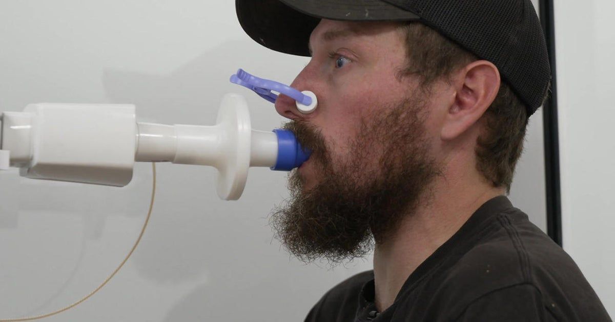 The increasing hazard of black lung disease facing coal miners