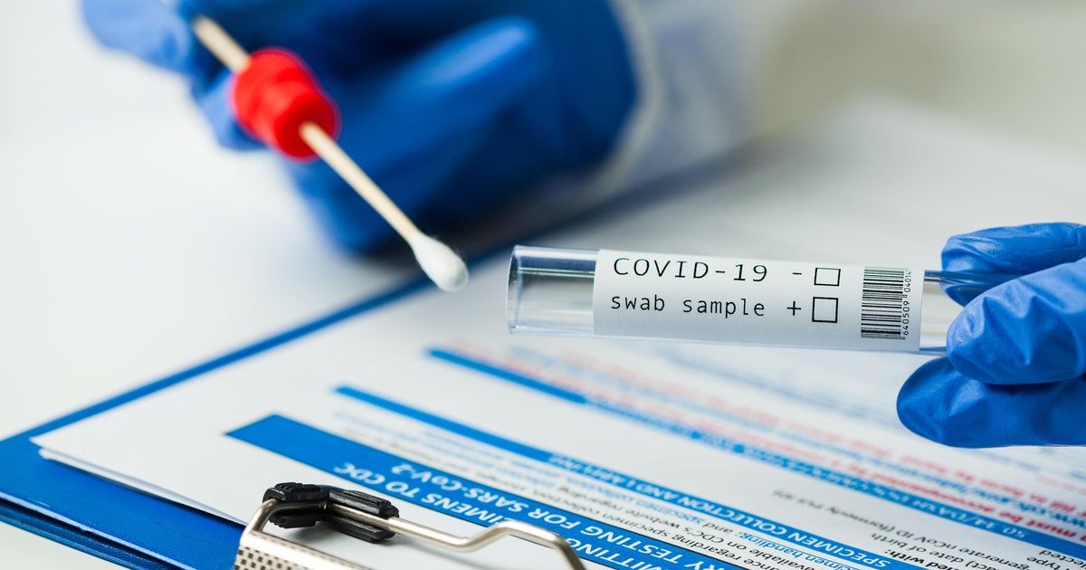 “No evidence” new COVID variant LB.1 causes more severe disease, CDC says
