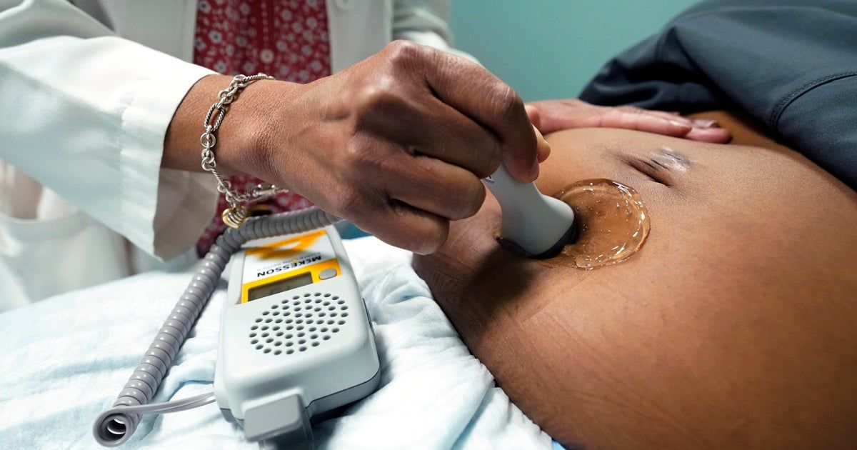 Miles from treatment and pregnant: How women in maternity care deserts are coping as health care options dwindle Miles from treatment and pregnant: How women in maternity care deserts are coping as health care options dwindle