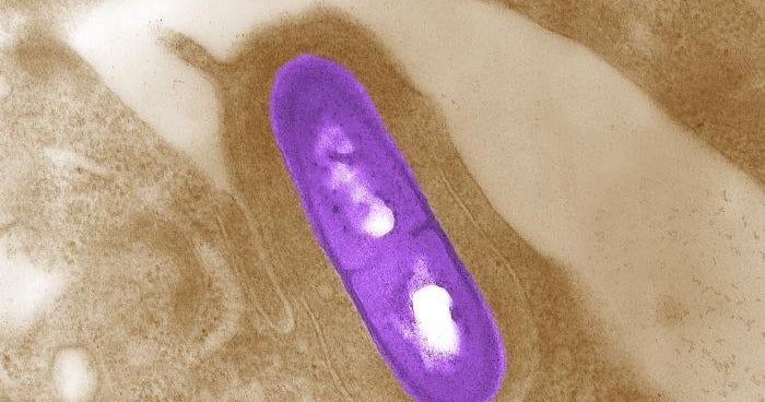 Costco, Trader Joe’s and Walmart products made with cheese linked to deadly listeria outbreak
