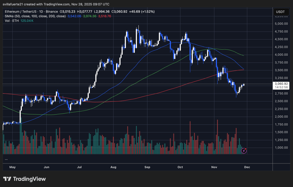 ETH consolidates around $3K level | Source: ETHUSDT chart on TradingView