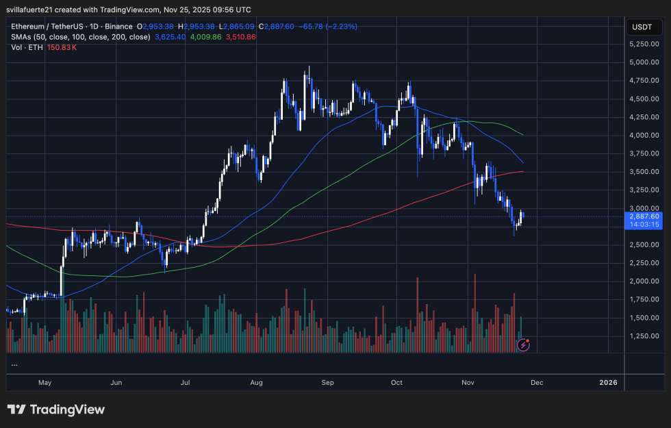 Bitmine Accumulates Nearly 70K Ethereum But Faces $4.25B Unrealized Loss At Current Prices | Bitcoinist.com 3 ETH struggling to reclaim higher prices | Source: ETHUSDT chart on TradingView