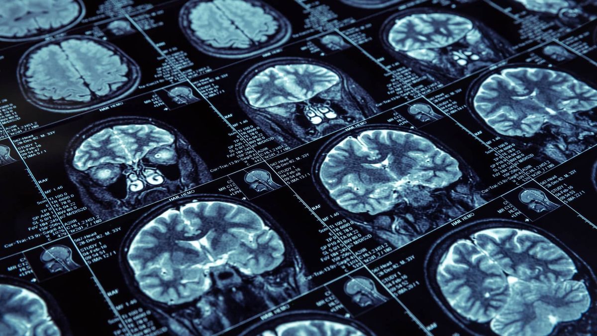 A new consumer privacy battle is underway as tech gadgets capture our brain waves A new consumer privacy battle is underway as tech gadgets capture our brain waves