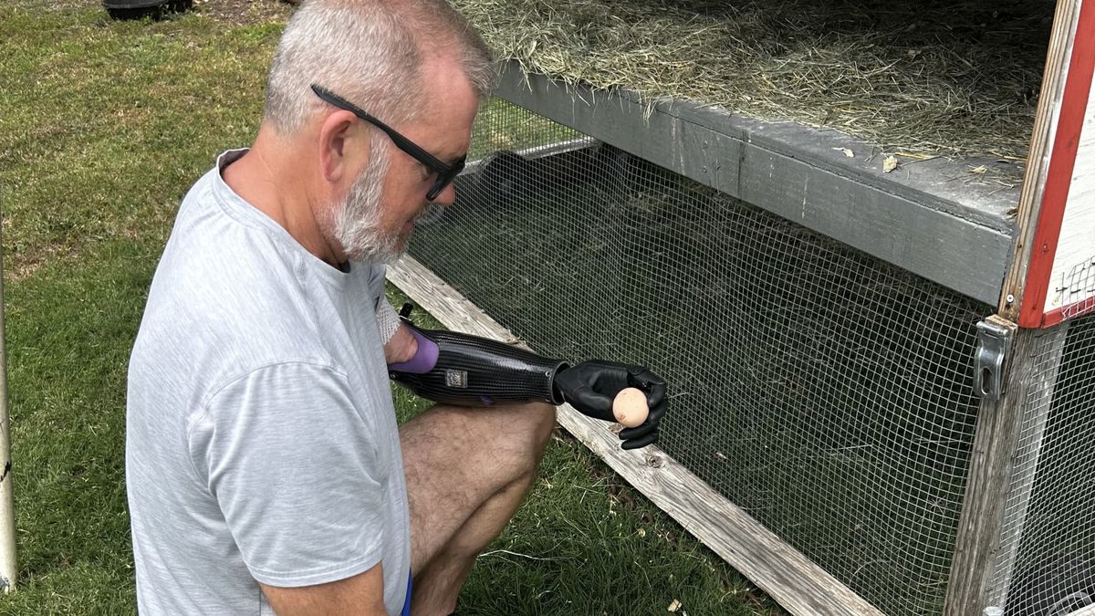 Amputees say this bionic hand startup gives them both strength and grace — they can even pick up raw eggs without crushing them