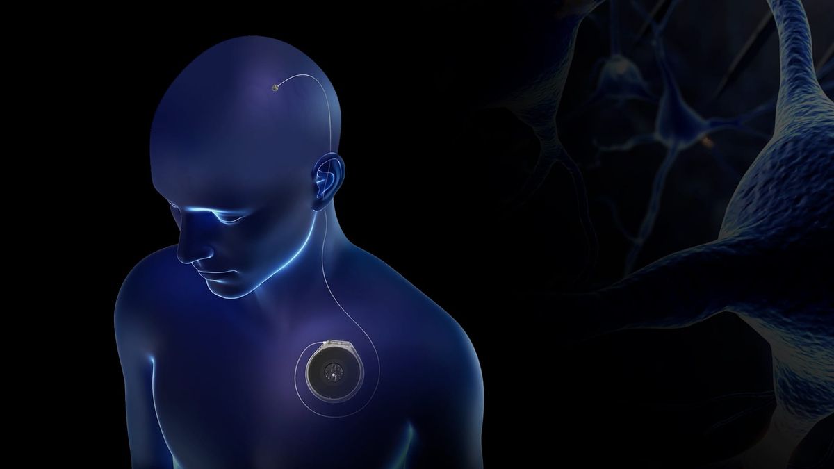 Neuralink competitor Paradromics completes first human implant 1 Inside Paradromics, the Neuralink competitor hoping to commercialize brain implants before the end of the decade