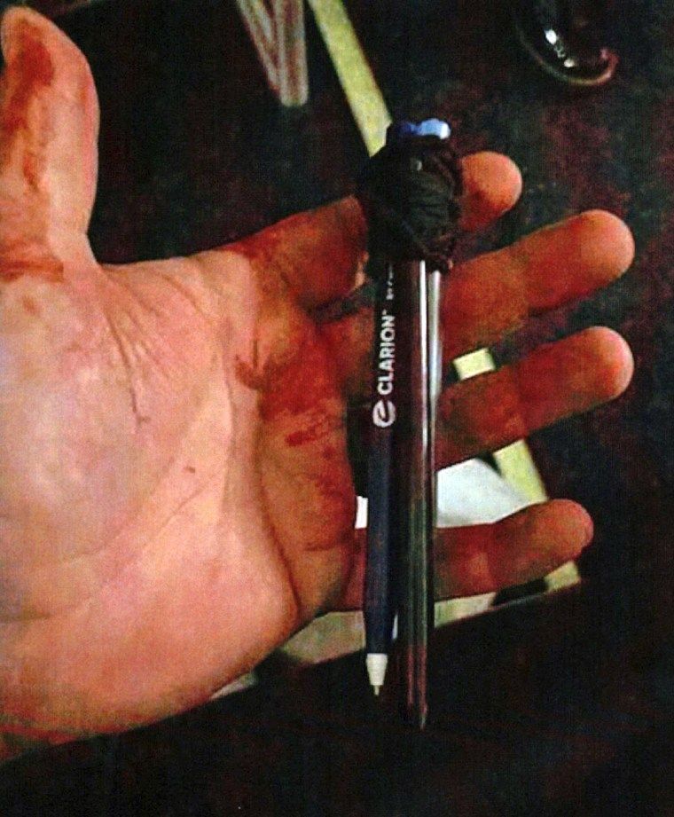 Passenger stabs fellow traveler with weapon of pens and rubber bands on Seattle-to-Vegas flight 2 A bloody hand holding pens wrapped in rubber bands.